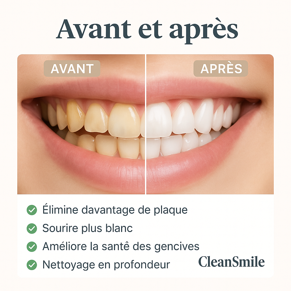Brosse à dents électrique blanchiment dentaire