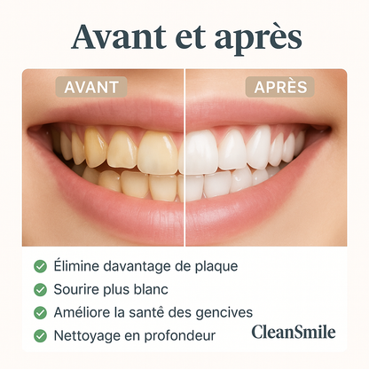 Brosse à dents électrique blanchiment dentaire